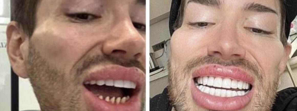 À 27 ans il veut à tout prix ressembler à la poupée Ken !